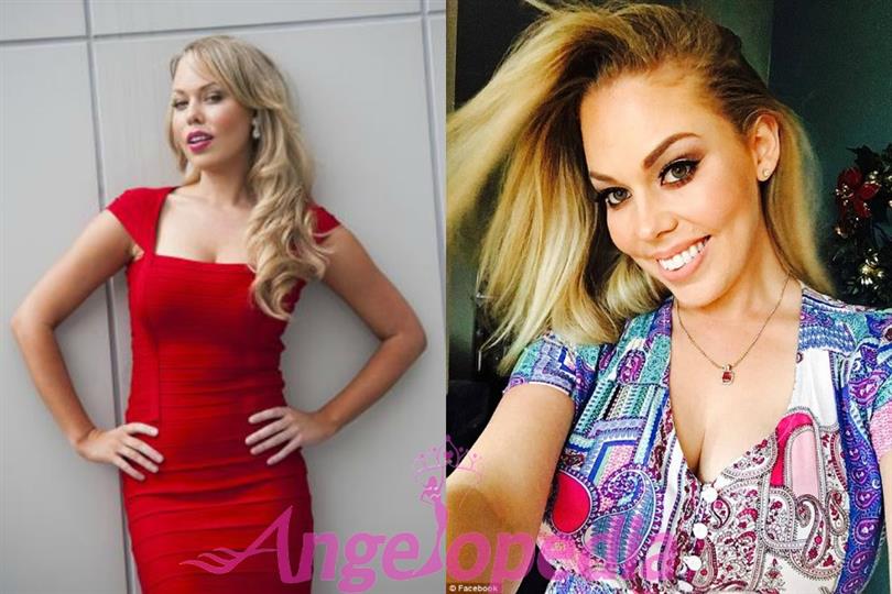 Former beauty queen left burnt in a drug raid by Police?