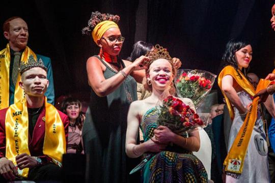A Look into the World of Albino Beauty Pageants